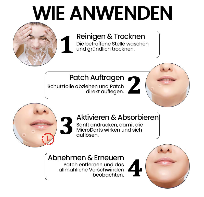 KUBOZN® Pro MicroDarts TAG'Gone Hautpflaster zur Skin-Tag-Entfernung (offer)