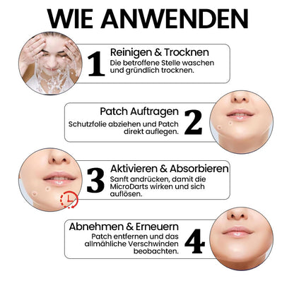 KUBOZN® Pro MicroDarts TAG'Gone Hautpflaster zur Skin-Tag-Entfernung (offer)